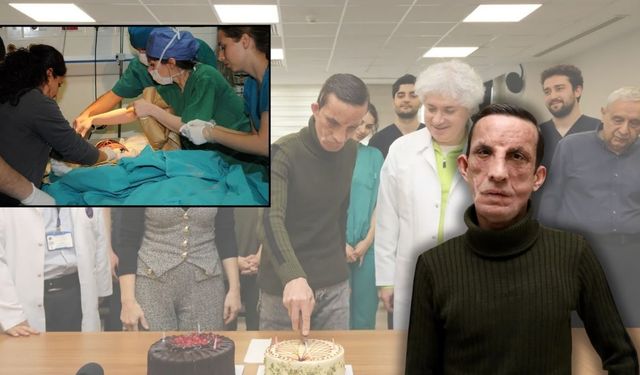 Türkiye’nin ilk yüz nakli hastası Uğur Acar 14. yılında doktorlarıyla buluştu